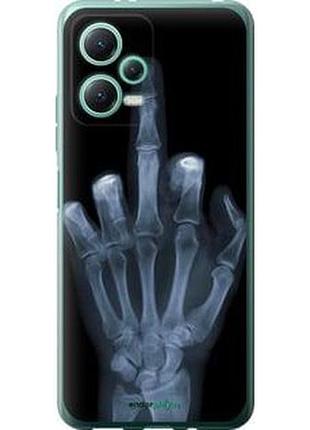Чохол на xiaomi poco x5 5g рука через рентген "1007u-3016-7673"