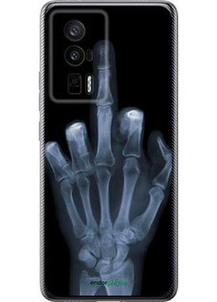 Чохол на xiaomi poco f5 pro 5g рука через рентген "1007u-3193-7673"