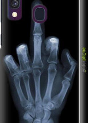 Чохол на samsung galaxy a40 2019 a405f рука через рентген "1007m-1672-7673"