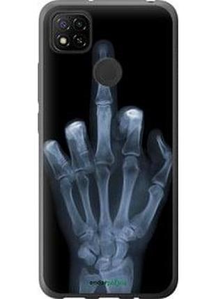 Чохол на xiaomi redmi 9c рука через рентген "1007u-2035-7673"