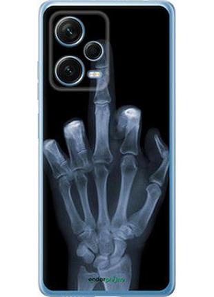 Чохол на xiaomi redmi note 12 pro+ 5g рука через рентген "1007u-3612-7673"