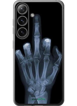 Чохол на samsung galaxy s24 рука через рентген "1007u-3390-7673"