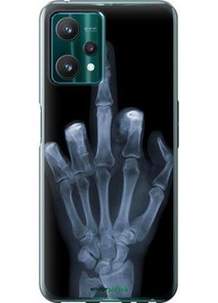 Чохол на realme 9 pro рука через рентген "1007u-2595-7673"