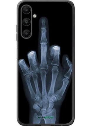 Чохол на samsung galaxy a05s рука через рентген "1007u-3356-7673"