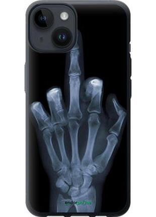Чохол на iphone 14 рука через рентген "1007u-2648-7673"