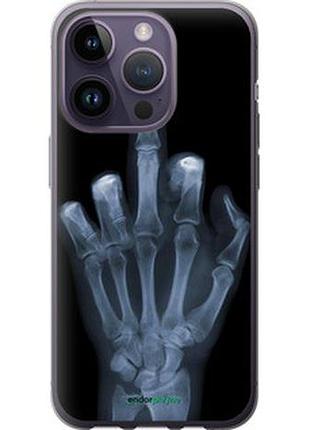 Чохол на iphone 14 pro рука через рентген "1007u-2646-7673"