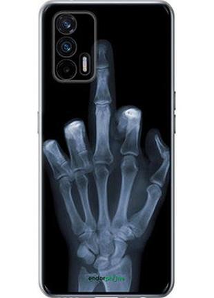 Чохол на realme gt 5g рука через рентген "1007u-3338-7673"