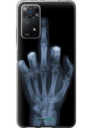 Чохол на xiaomi redmi note 12 pro рука через рентген "1007u-3019-7673"