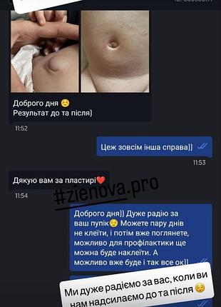 Пластир для пупка