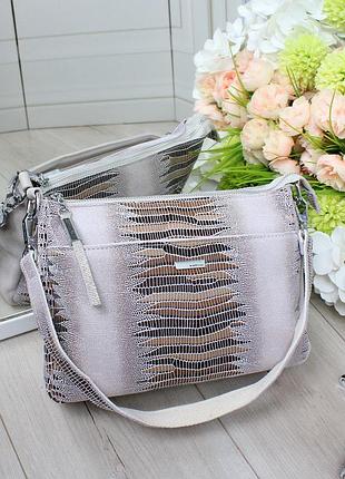 Сумка жіноча із лазерної натуральної шкіри 🔥