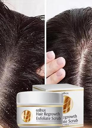 Быстрое средство против перхоти, скраб для лечения зуда, очистка кожи головы, отшелушивающие средства, контроль жирности