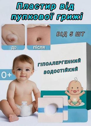 Пупочный пластырь бандаж от грыжи противогрыжевый детский для пупка
