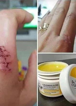 Бальзам календула