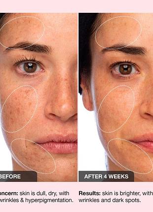 Легкий, шелковистый увлажняющий крем с 10% витамина с и пептидным комплексом innbeauty project 10 + 10 moisturizer