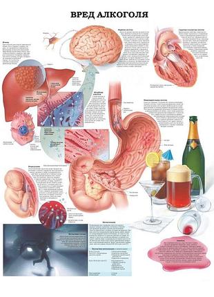 Плакат а3. вред алкоголя ламінація