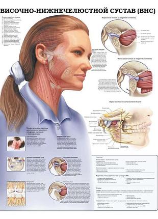 Плакат а3. височно-нижнечелюстной сустав (внс) ламінація