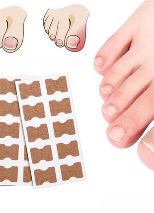 Наклейки пластырь от вростания ногтей 50 шт набор