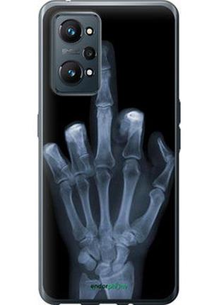 Чохол на realme gt neo 2 рука через рентген "1007u-2489-7673"