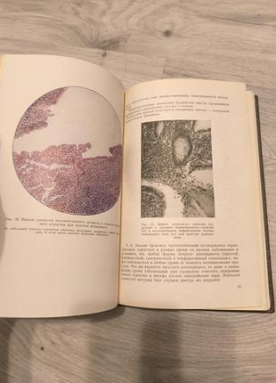 Книга "острый апендецыт" 3