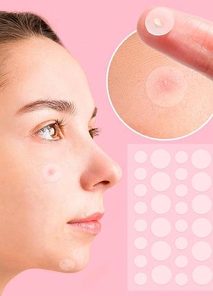 Пластир від прищів та акне 72шт acne patch