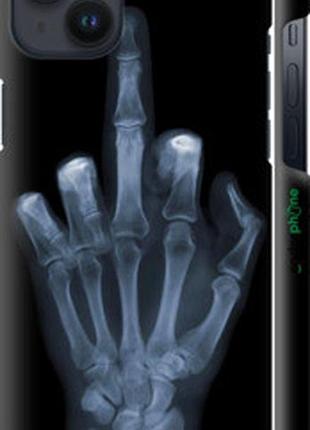 Чохол на iphone 14 plus рука через рентген "1007m-2645-73076"