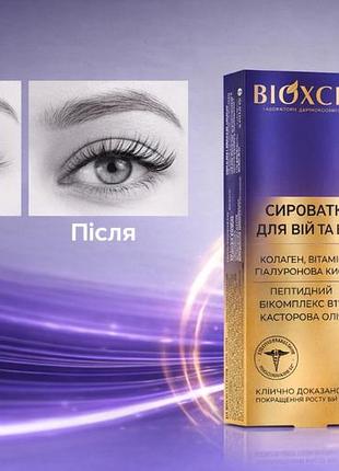 Bioxcin -сыворотка для роста ресниц - туречева