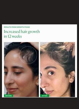 Сироватка для росту волосся 3