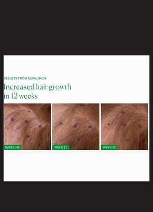 Сироватка для росту волосся 4