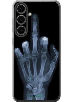 Чохол на samsung galaxy s24 fe рука через рентген "1007u-3772-7673"