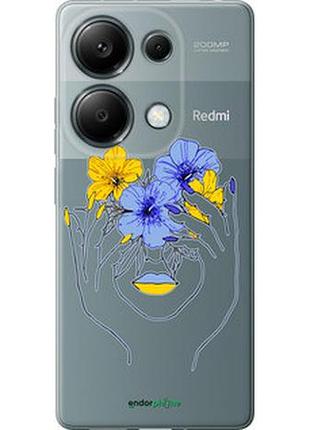 Чохол на xiaomi redmi note 13 pro 4g дівчина v4 "5276u-3653-7673"