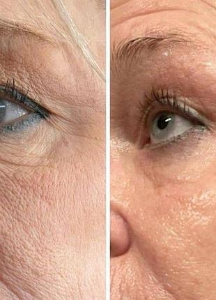 Крем для зони навколо очей з ретинолом