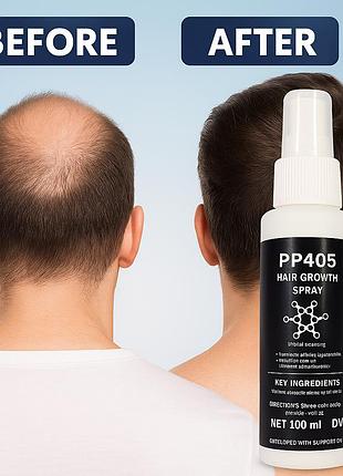 Pp405 hair growth spray 100 мл – спрей для роста волос, укрепляет корни, стимулирует регенерацию фолликулов
