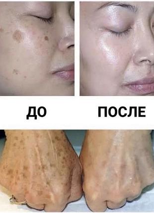 Expigment 4% оригиналь 7
