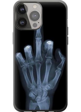 Чехол на iphone 13 pro max рука через рентген из силикона fch_0007887