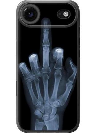 Чехол на iphone 17 air рука через рентген из силикона fch_0149312
