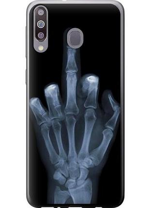 Чехол на samsung galaxy a40s a3050 рука через рентген из пластика fch_0007927