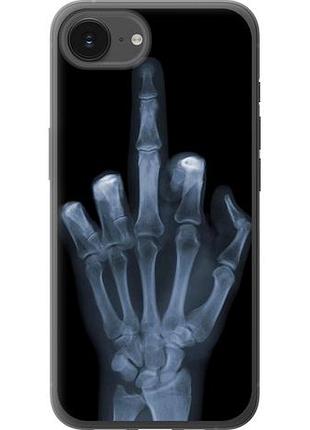Чехол на iphone 16e рука через рентген из силикона fch_0147723