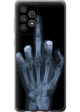 Чехол на samsung galaxy a73 a736b рука через рентген из силикона fch_0007889