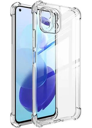 Tpu чехол getman ease logo усиленные углы full camera для xiaomi mi 11 lite бесцветный (прозрачный)