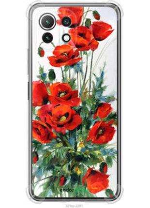 Чехол на xiaomi mi 11 lite маки "523sp-2281-2448"