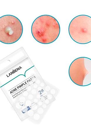 Гидроколлоидные патчи lanbena acne pimple patch night use 28 шт от прыщей и угрей против акне ночные шт 2