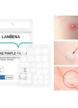Гидроколлоидные патчи lanbena acne pimple patch night use 28 шт от прыщей и угрей против акне ночные шт 5