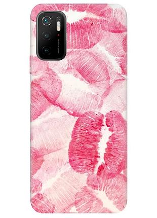 Чехол на xiaomi redmi note 10 5g :: поцелуйчики (принт 93)