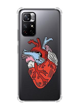 Чехол с утолщёнными углами для xiaomi redmi note 11 5g :: сердце анатомическое (принт 250)
