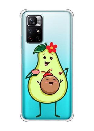 Чохол з потовщеними кутами на xiaomi redmi note 11 4g :: малюк авокадо (принт 309)