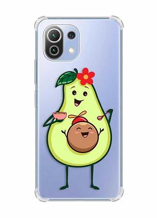Чехол с утолщёнными углами на xiaomi mi 11 lite :: малыш авокадо (принт 309)
