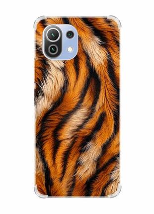 Чехол с утолщёнными углами на xiaomi mi 11 lite тигровый мех (принт 395)