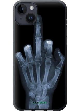 Чехол на iphone 14 plus рука через рентген "1007u-2645-10746"