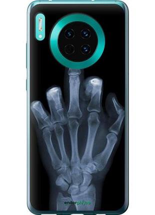 Чехол на huawei mate 30 рука через рентген "1007u-1773-10746"