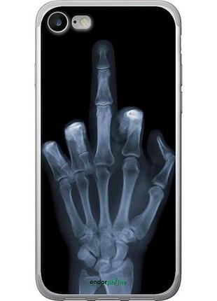 Чохол на iphone se 2022 рука через рентген "1007u-3737-10746"